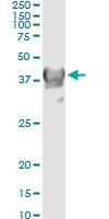 5 - CRYM Antibody (monoclonal) (M03) AT1645a