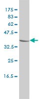 1 - CTBS Antibody (monoclonal) (M01) AT1666a