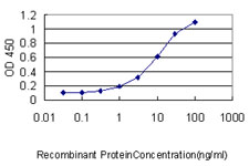 10 - CTL2 Antibody (monoclonal) (M01) AT1669a