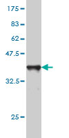 1 - CTL2 Antibody (monoclonal) (M01) AT1669a