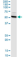 1 - CTNS Antibody (monoclonal) (M09) AT1679a