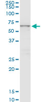 1 - CTNS Antibody (monoclonal) (M09) AT1679a
