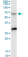 1 - CTNS Antibody (monoclonal) (M09) AT1679a
