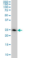 1 - DCXR Antibody (monoclonal) (M03) AT1728a