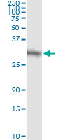 5 - DKK1 Antibody (monoclonal) (M11) AT1769a