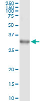 5 - DLX1 Antibody (monoclonal) (M01) AT1774a