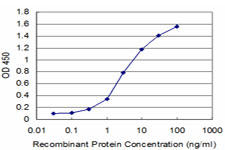 10 - DLX5 Antibody (monoclonal) (M07) AT1782a