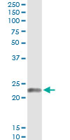 5 - EDN1 Antibody (monoclonal) (M01) AT1850a