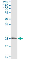 5 - EDN3 Antibody (monoclonal) (M01) AT1852a