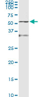 5 - ENO1 Antibody (monoclonal) (M01) AT1908a