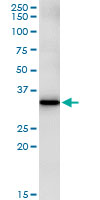 5 - FBXO6 Antibody (monoclonal) (M01) AT2021a