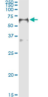 5 - FOXA2 Antibody (monoclonal) (M01) AT2085a