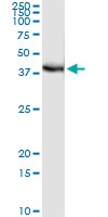 5 - FRG1 Antibody (monoclonal) (M01) AT2107a