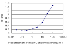 10 - FVT1 Antibody (monoclonal) (M01) AT2126a