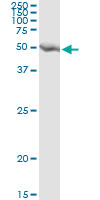 5 - GART Antibody (monoclonal) (M01) AT2154a