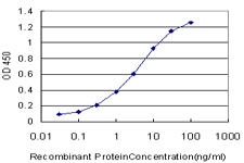 10 - GCM1 Antibody (monoclonal) (M05) AT2180a