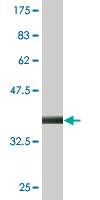 1 - GLYCTK Antibody (monoclonal) (M02) AT2216a