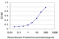 10 - GMPPB Antibody (monoclonal) (M07) AT2222a