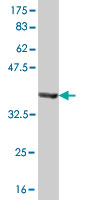1 - GMPPB Antibody (monoclonal) (M07) AT2222a