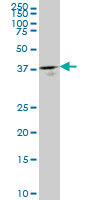 1 - GMPPB Antibody (monoclonal) (M07) AT2222a