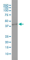 1 - GNB3 Antibody (monoclonal) (M01) AT2228a