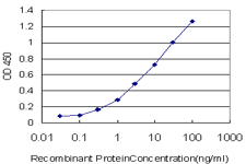 10 - GRHPR Antibody (monoclonal) (M01) AT2260a