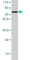 1 - GSDML Antibody (monoclonal) (M06) AT2271a