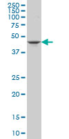 1 - GSDML Antibody (monoclonal) (M06) AT2271a