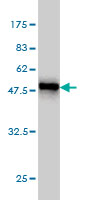 1 - GSTA3 Antibody (monoclonal) (M01) AT2277a
