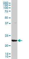 1 - GSTA3 Antibody (monoclonal) (M01) AT2277a