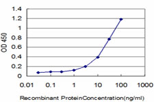 10 - GSTM5 Antibody (monoclonal) (M01) AT2280a