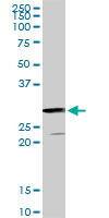 1 - GSTZ1 Antibody (monoclonal) (M01) AT2284a