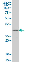 1 - GSTZ1 Antibody (monoclonal) (M01) AT2284a