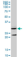 1 - GSTZ1 Antibody (monoclonal) (M01) AT2284a