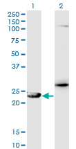 1 - GSTZ1 Antibody (monoclonal) (M01) AT2284a
