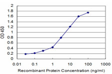10 - GTF2I Antibody (monoclonal) (M02) AT2290a
