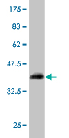 1 - GYG1 Antibody (monoclonal) (M08) AT2303a