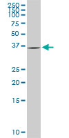 1 - GYG1 Antibody (monoclonal) (M08) AT2303a