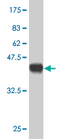 1 - GYG2 Antibody (monoclonal) (M04) AT2304a
