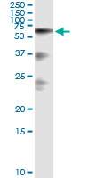 5 - HABP2 Antibody (monoclonal) (M01) AT2308a