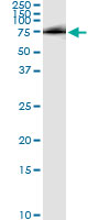 5 - HHIP Antibody (monoclonal) (M01) AT2366a