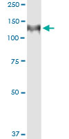 5 - HIP1 Antibody (monoclonal) (M01) AT2370a