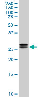 1 - HMGB2 Antibody (monoclonal) (M05) AT2387a