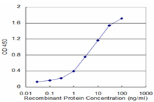 10 - HPD Antibody (monoclonal) (M07) AT2433a