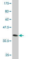 1 - HSPC152 Antibody (monoclonal) (M09) AT2452a