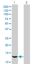 1 - HSPC152 Antibody (monoclonal) (M09) AT2452a