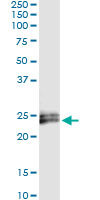5 - IFNE1 Antibody (monoclonal) (M01) AT2489a