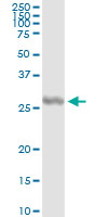 5 - IL27 Antibody (monoclonal) (M01) AT2518a