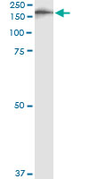 5 - IQGAP3 Antibody (monoclonal) (M01) AT2537a