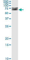 5 - IRAK1 Antibody (monoclonal) (M02) AT2539a